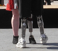 people with artificial legs dancing Argentine Tango